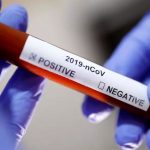 coronavirus